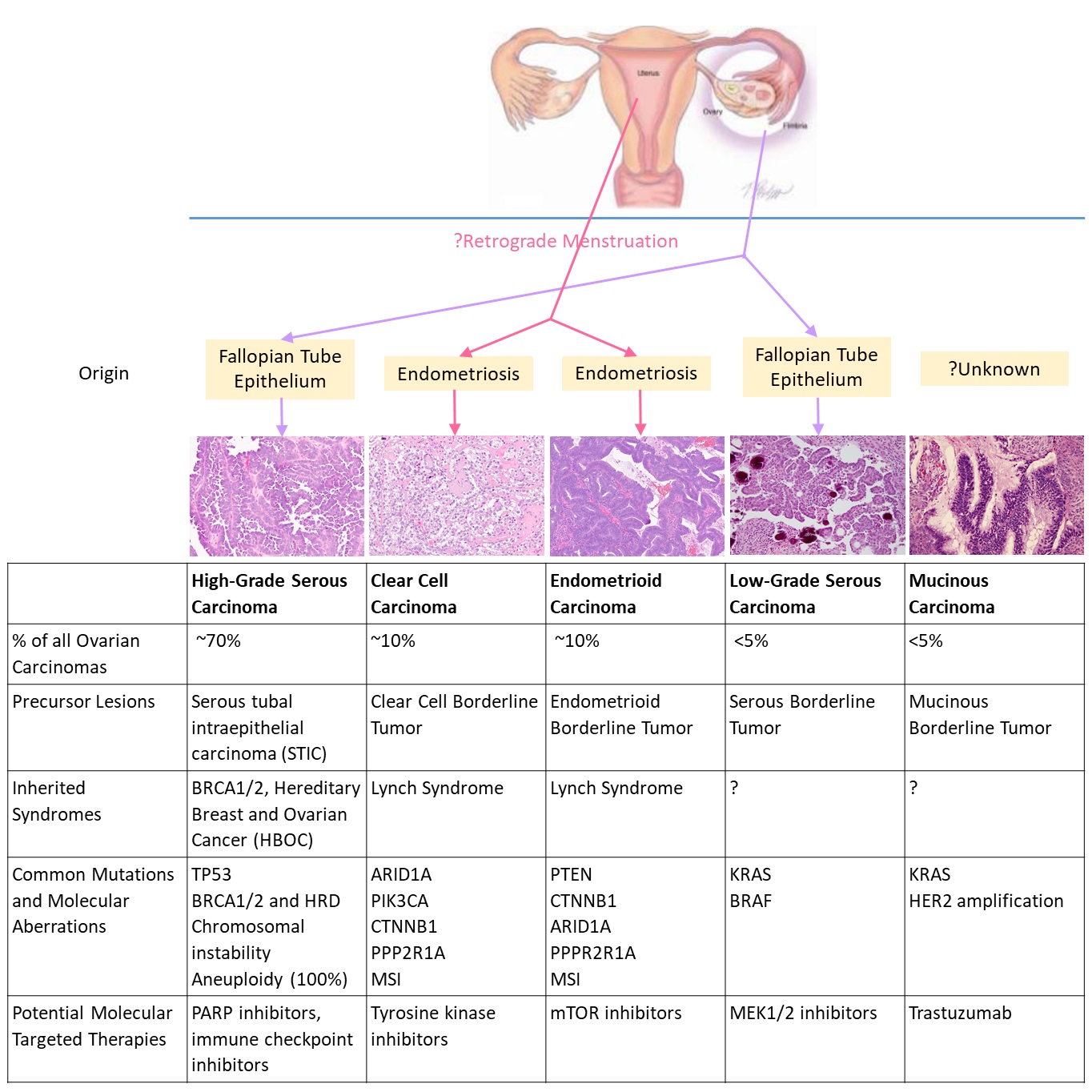 2-histological-classification-of-ovarian-carcinoma